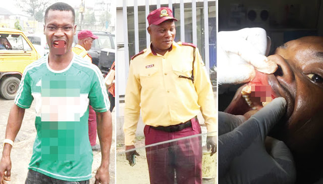 LASTMA, police personnel knock out driver’s teeth in a combat fight [PHOTOs]