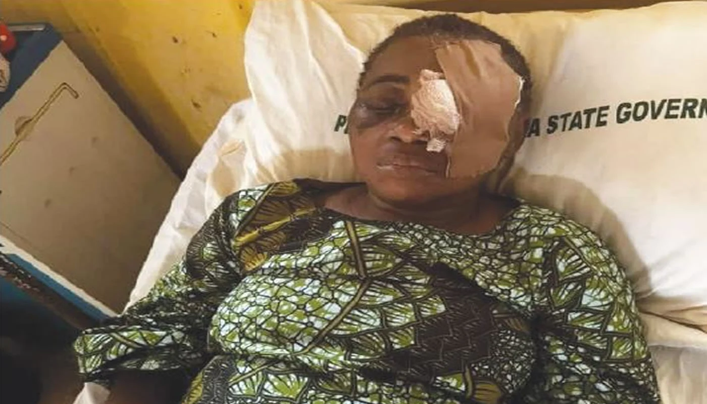 How Ritualist Attempted To Harvest My Eyes — Lagos-Based Lawyer